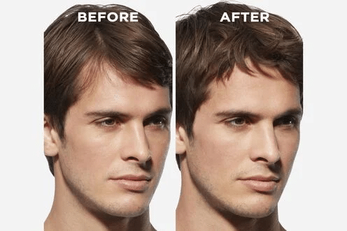 Kerastase Genesis Homme Serum Anti-Chute Fortifant 90ml